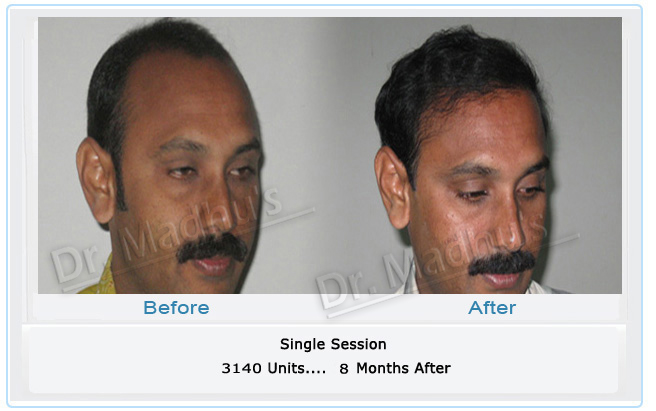 images-cosmetic-dermatology-india